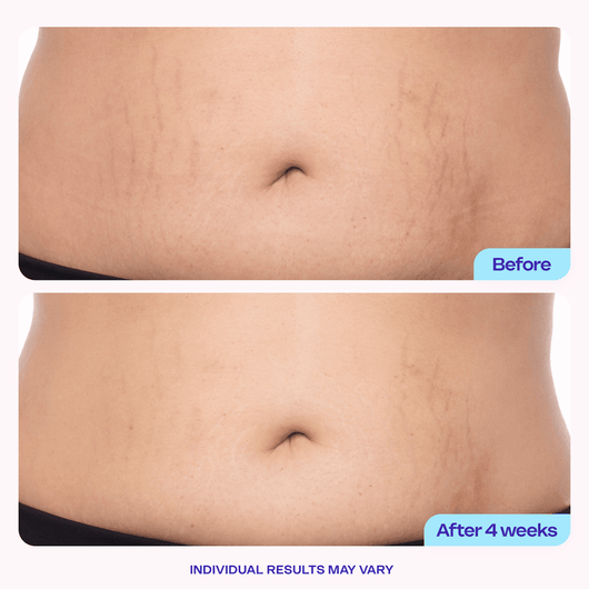 Clarora Tighten & Smooth Belly Cream