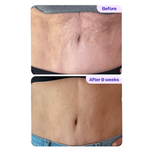 Clarora Tighten & Smooth Belly Cream