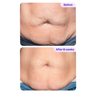 Clarora Tighten & Smooth Belly Cream