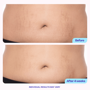 Clarora Tighten & Smooth Belly Cream